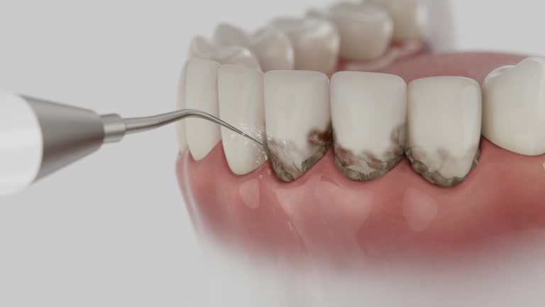 Trusted Dental Crowns And Bridges service in Bradford, OH - Dentist Open Now